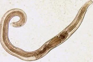 Les parasites de l'Homme Madenwürmer